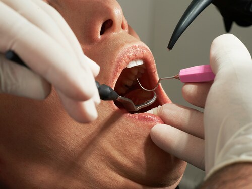6 Signs It’s Time to Book an Appointment with Your Local Dental Clinic